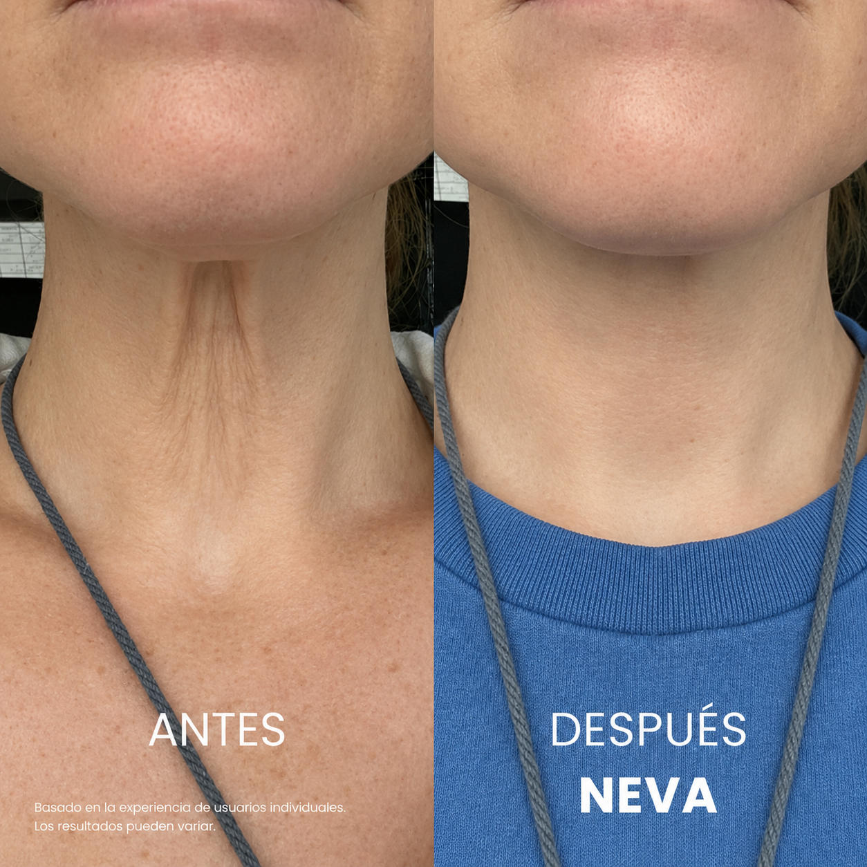 NEVA™ — Crema Reafirmante para Cuello y Escote