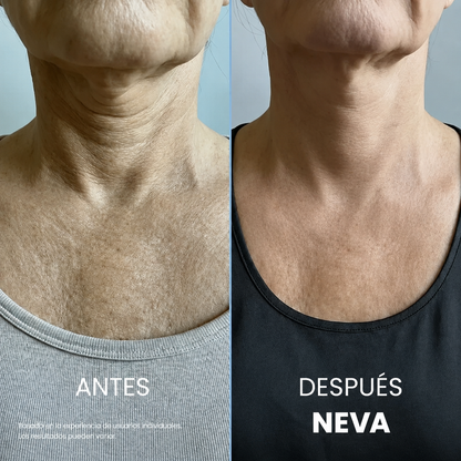 NEVA™ — Crema Reafirmante para Cuello y Escote