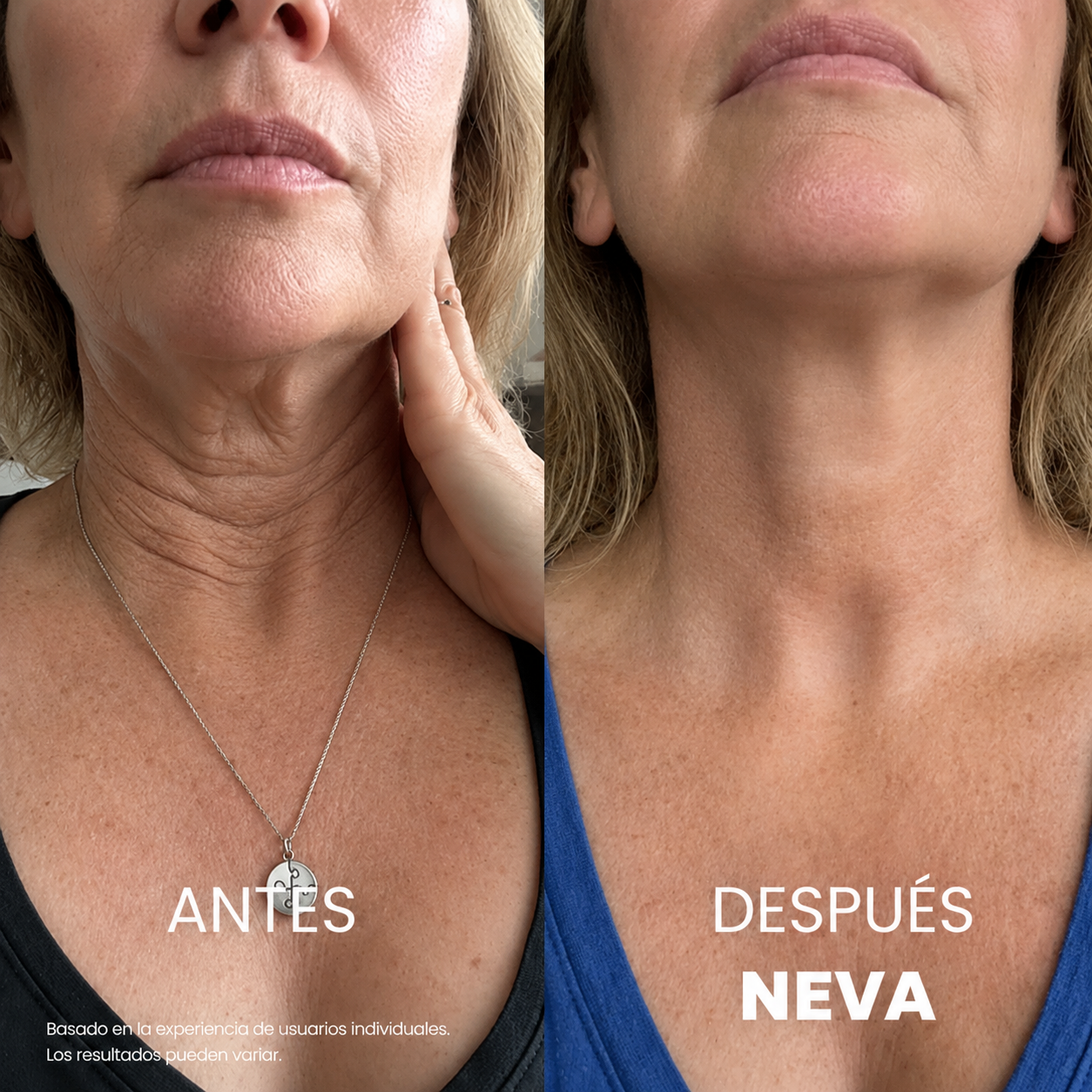 NEVA™ — Crema Reafirmante para Cuello y Escote