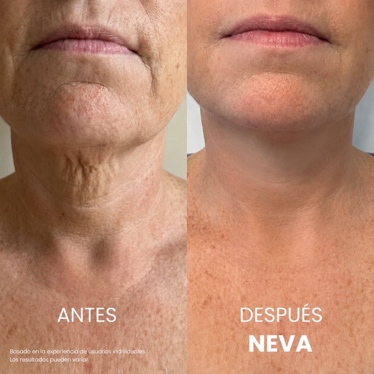 NEVA™ — Crema Reafirmante para Cuello y Escote